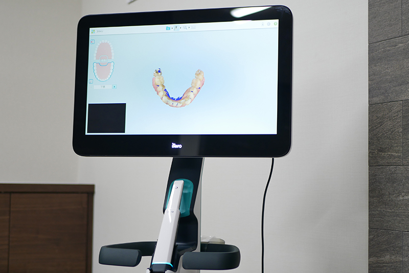 口腔内スキャナー