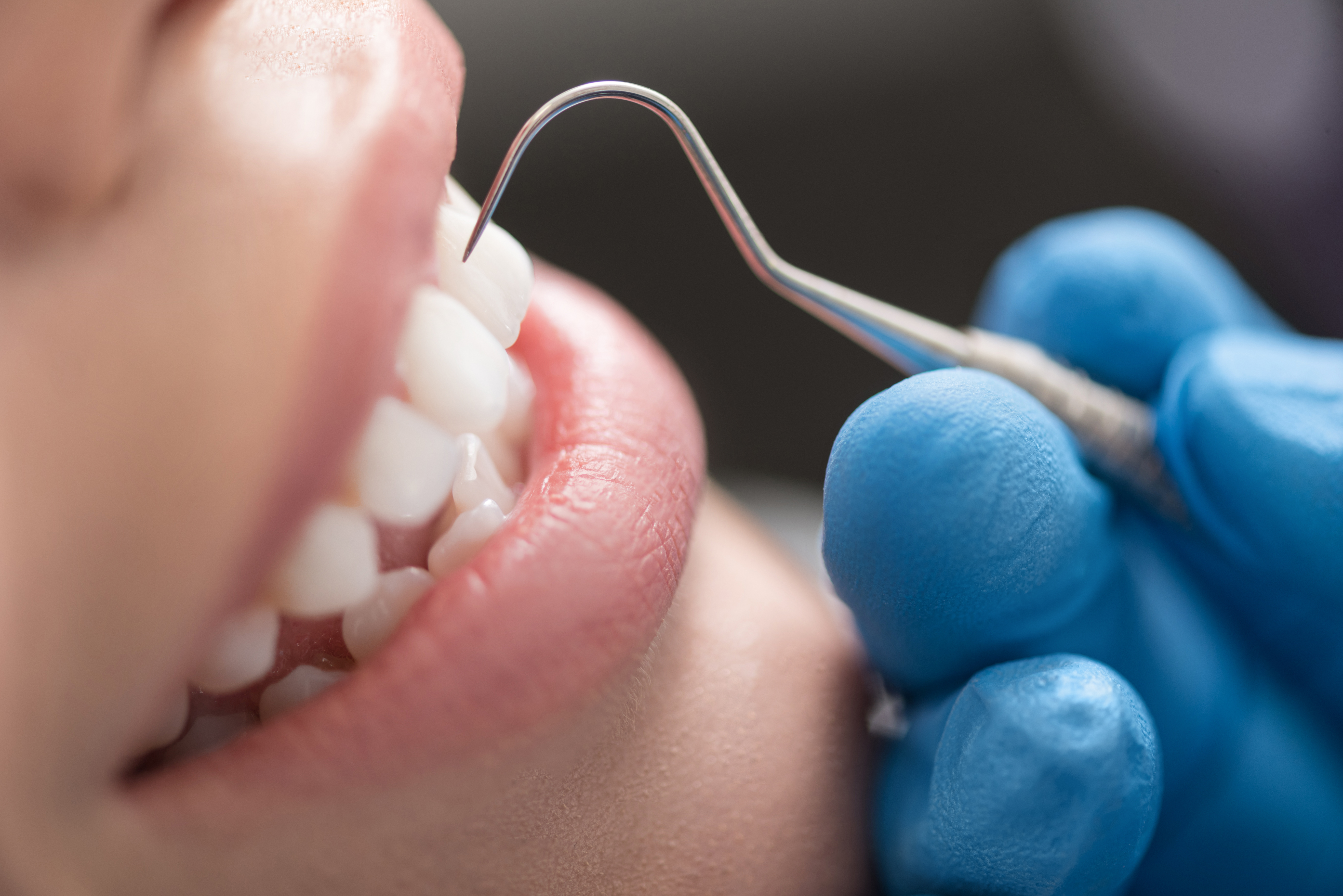 患者さまごとに専任の歯科衛生士が担当します